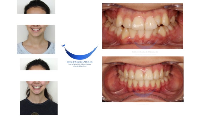 Orthodontiste Armand Birgy proche de Sceaux