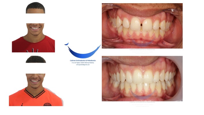 Orthodontiste Armand Birgy proche de Massy